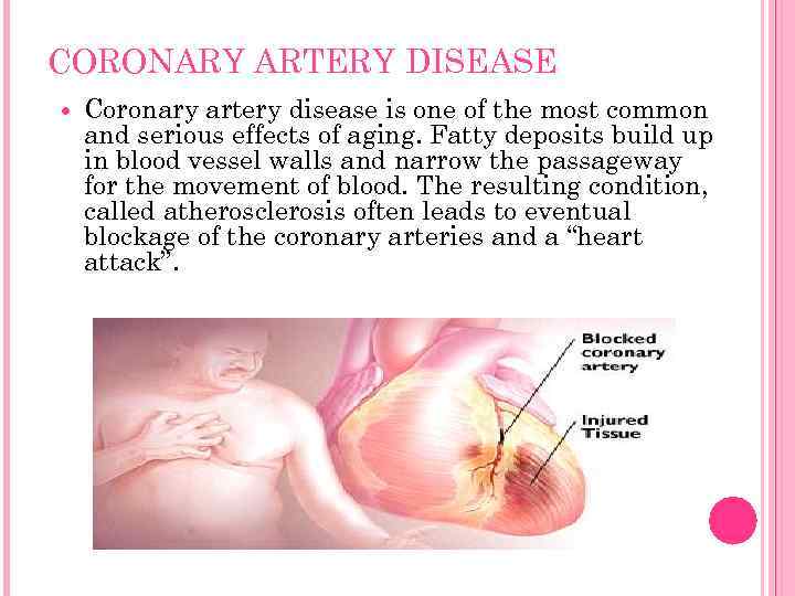 CORONARY ARTERY DISEASE Coronary artery disease is one of the most common and serious