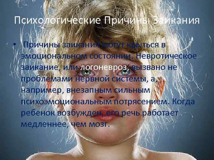 Психологические Причины Заикания • Причины заикания могут крыться в эмоциональном состоянии. Невротическое заикание, или