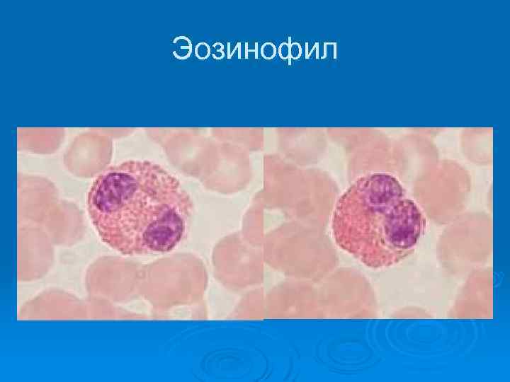 Эозинофил 