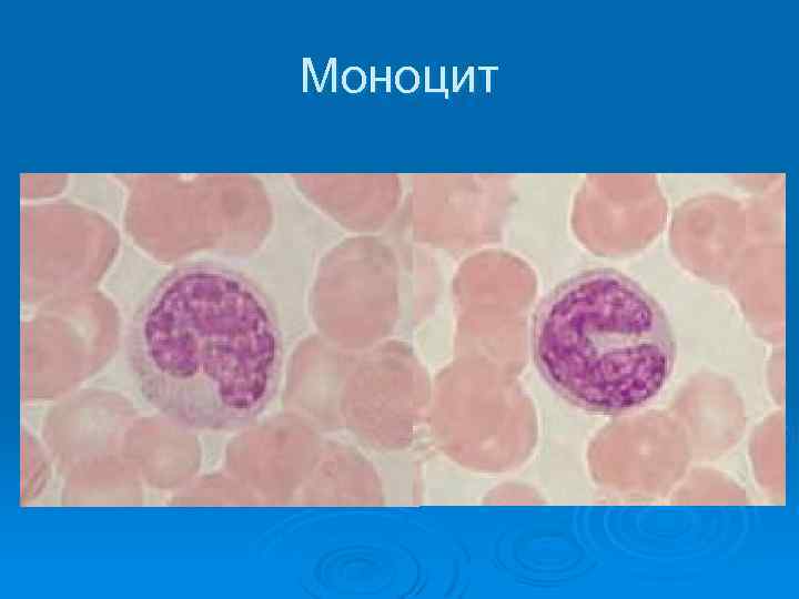 Моноцит 