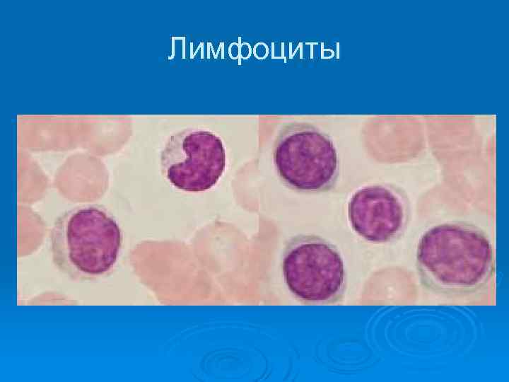 Лимфоциты 