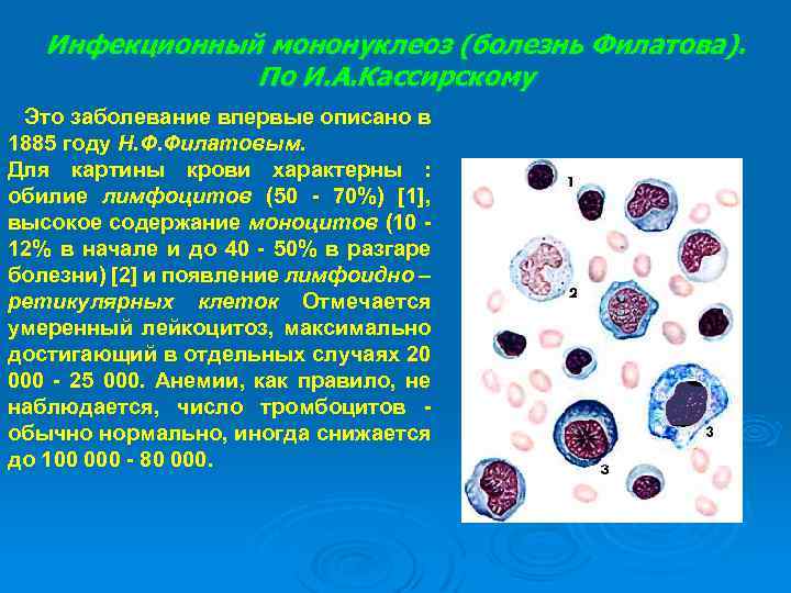 Инфекционный мононуклеоз картина крови