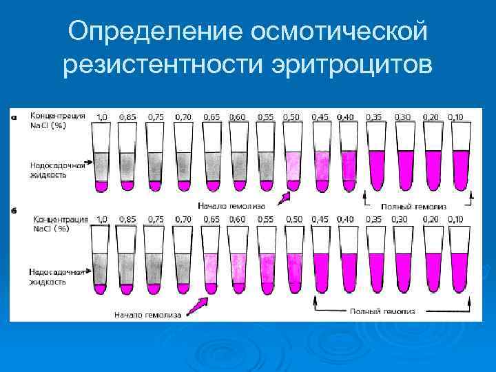 Определение осмотической резистентности эритроцитов 