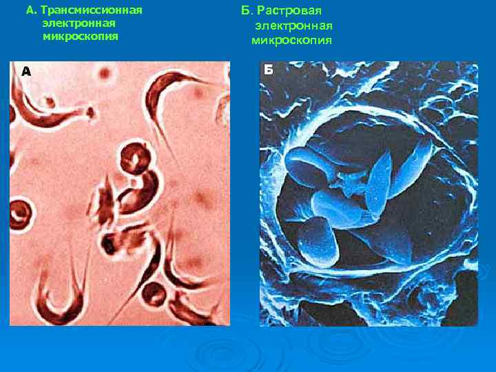 А. Трансмиссионная электронная микроскопия Б. Растровая электронная микроскопия 