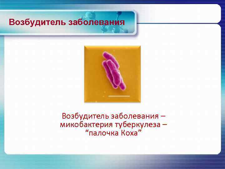 Возбудитель заболевания – микобактерия туберкулеза – “палочка Коха” 