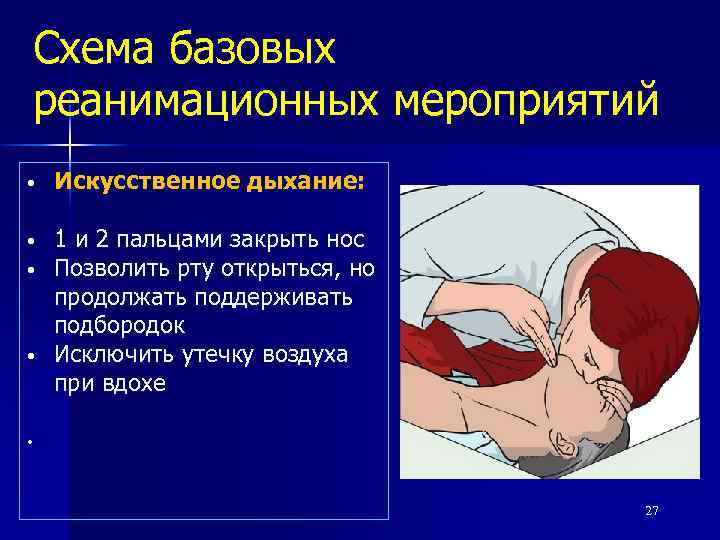 Искусственное дыхание схема