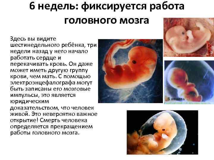 6 эмбриональная неделя