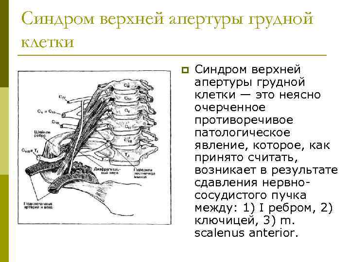 Синдром верхней апертуры грудной клетки p Синдром верхней апертуры грудной клетки — это неясно