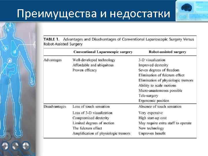 Преимущества и недостатки 