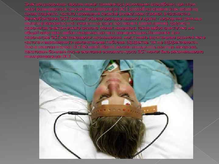 Электросудорожная терапия может применяться различными способами, при этом могут варьироваться три основных параметра ЭСТ: