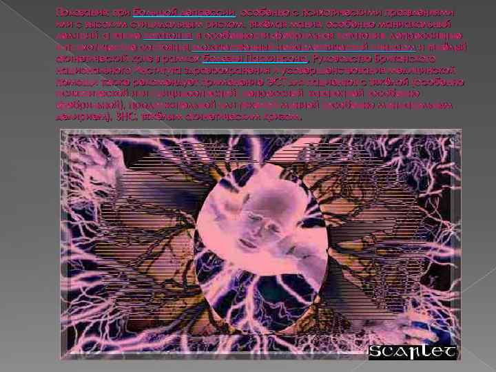 Показания: при большой депрессии, особенно с психотическими проявлениями или с высоким суицидальным риском, тяжёлая