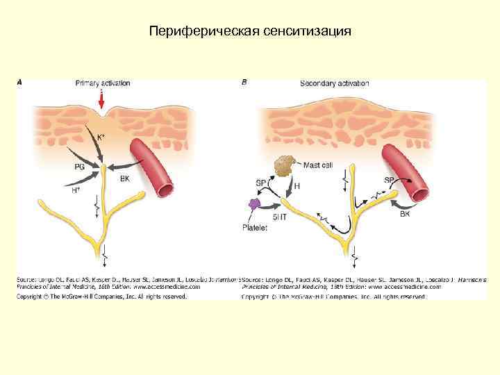 Периферическая сенситизация 