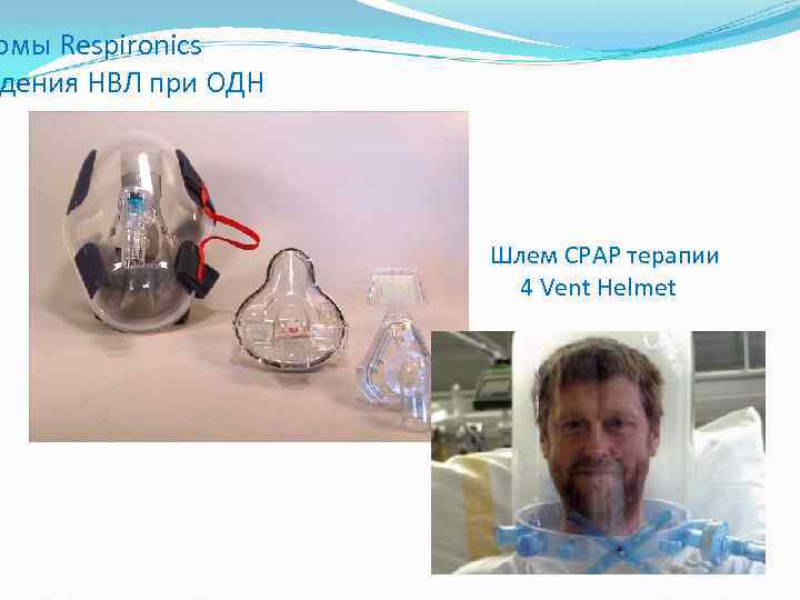 рмы Respironics дения НВЛ при ОДН Шлем CPAP терапии 4 Vent Helmet 