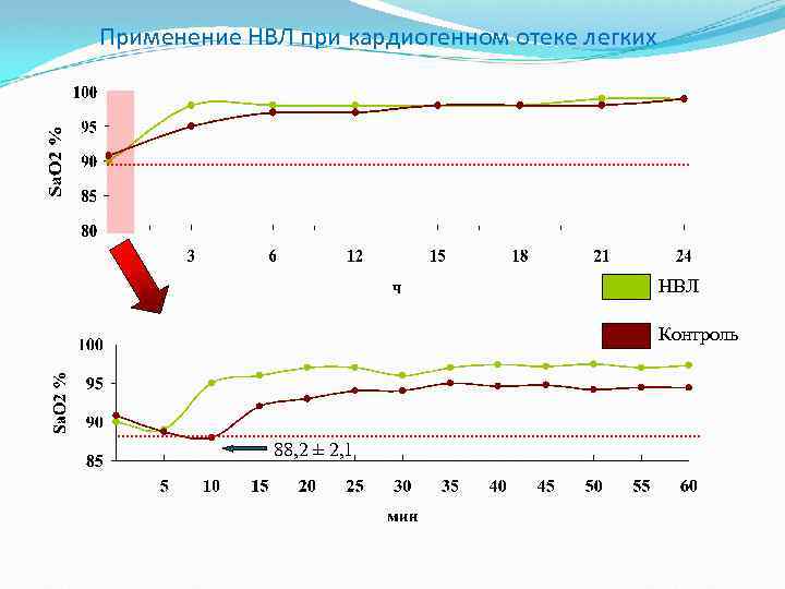 Применение НВЛ при кардиогенном отеке легких НВЛ Контроль 88, 2 ± 2, 1 