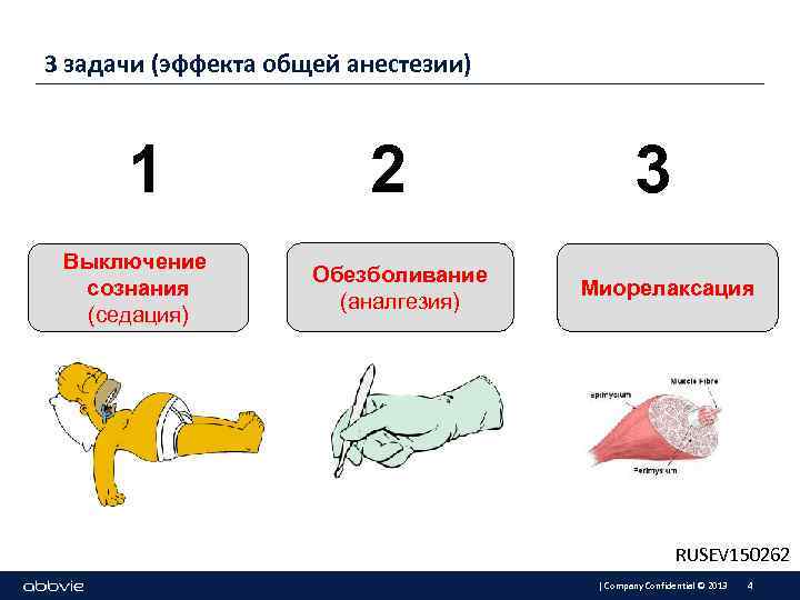 3 задачи (эффекта общей анестезии) 1 Выключение сознания (седация) 2 Обезболивание (аналгезия) 3 Миорелаксация