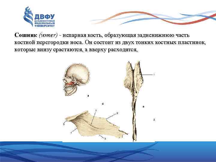 Сошник (vomer) - непарная кость, образующая задненижнюю часть костной перегородки носа. Он состоит из