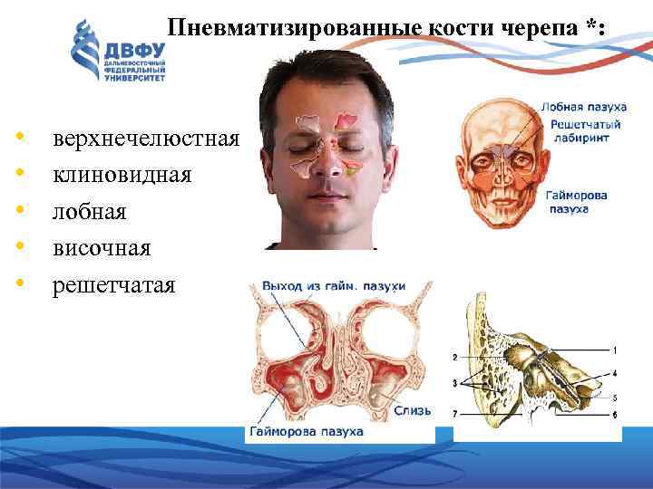 Пневматизированные кости черепа *: • • • верхнечелюстная клиновидная лобная височная решетчатая 