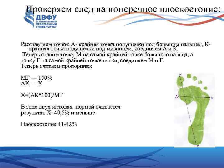 Проверяем след на поперечное плоскостопие: Расставляем точки: А крайняя точка подушечки под большим пальцем,