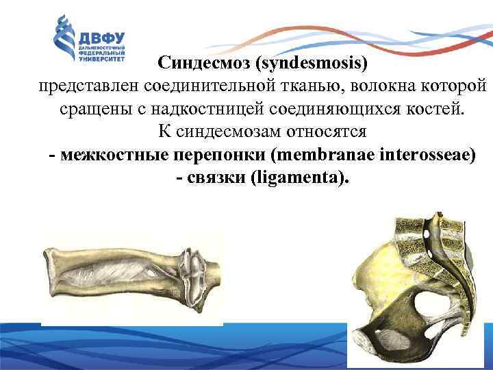 Синдесмоз (syndesmosis) представлен соединительной тканью, волокна которой сращены с надкостницей соединяющихся костей. К синдесмозам