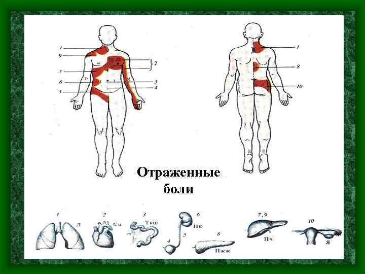 Отраженные боли 