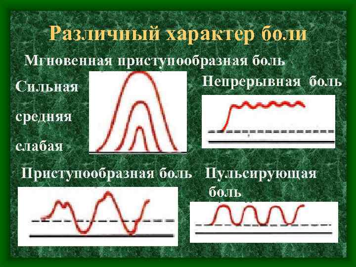 Различный характер боли Мгновенная приступообразная боль Непрерывная боль Сильная средняя слабая Приступообразная боль Пульсирующая