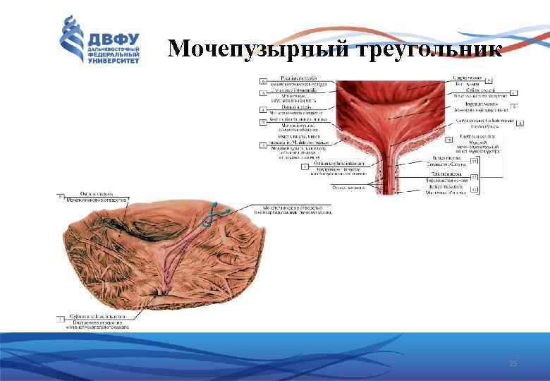 Мочепузырный треугольник 25 