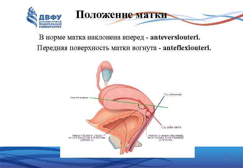 Положение матки В норме матка наклонена вперед anteversiouteri. Передняя поверхность матки вогнута anteflexiouteri. 71