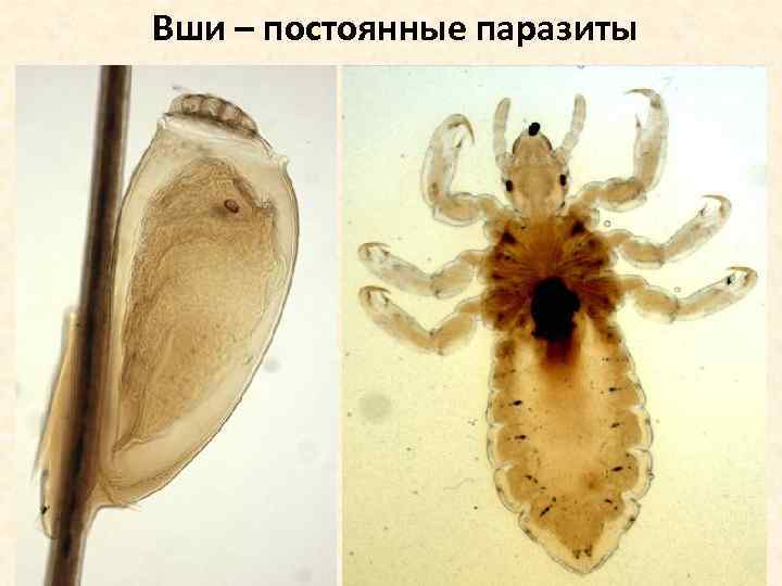 Вши – постоянные паразиты 