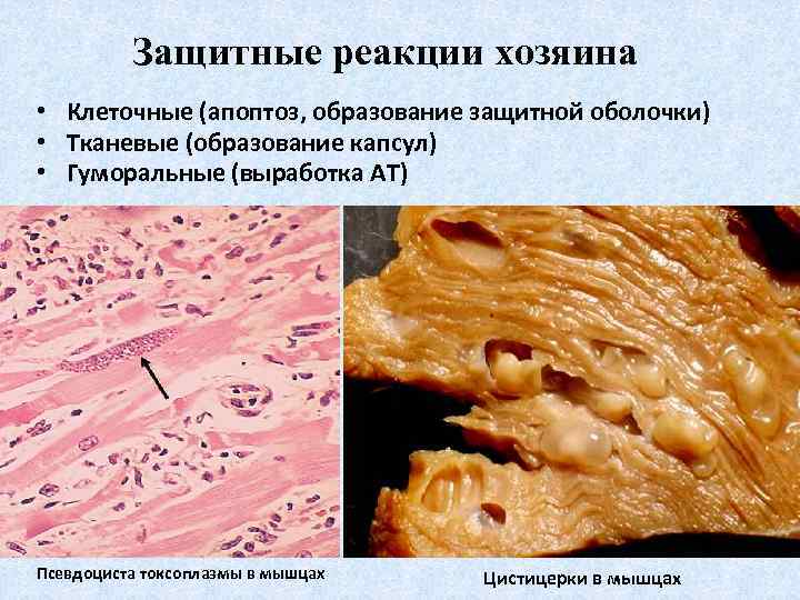 Защитные реакции хозяина • Клеточные (апоптоз, образование защитной оболочки) • Тканевые (образование капсул) •