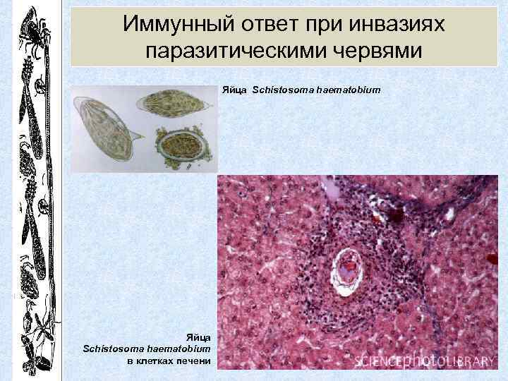 Иммунный ответ при инвазиях паразитическими червями Яйца Schistosoma haematobium в клетках печени 