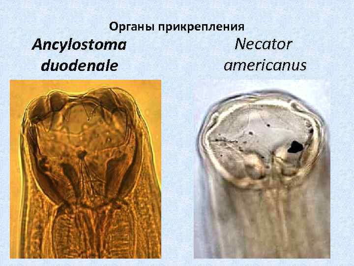 Органы прикрепления Ancylostoma duodenale Necator americanus 