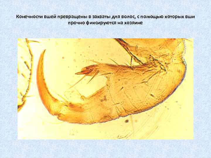 Конечности вшей превращены в захваты для волос, с помощью которых вши прочно фиксируются на