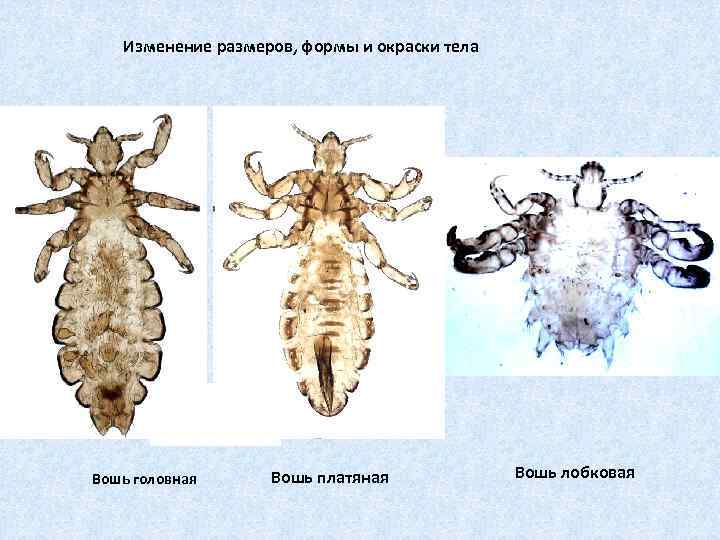 Изменение размеров, формы и окраски тела Вошь головная Вошь платяная Вошь лобковая 