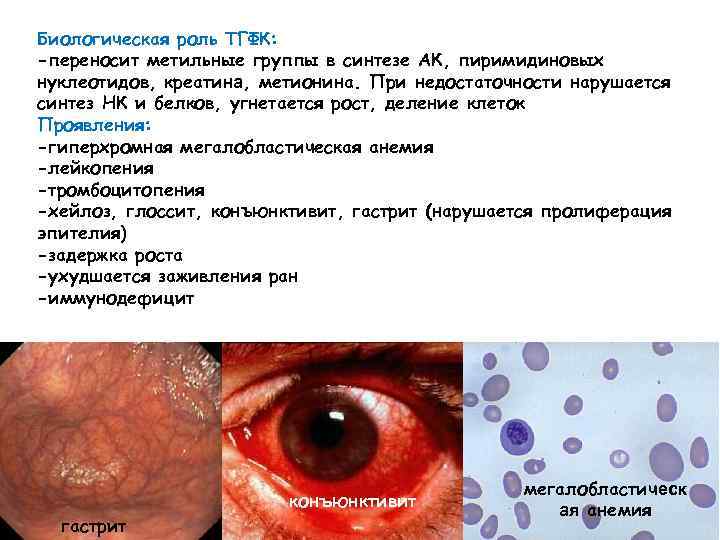 Биологическая роль ТГФК: -переносит метильные группы в синтезе АК, пиримидиновых нуклеотидов, креатина, метионина. При