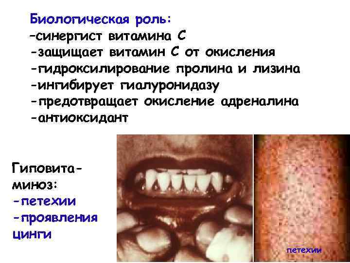 Биологическая роль: –синергист витамина С -защищает витамин С от окисления -гидроксилирование пролина и лизина