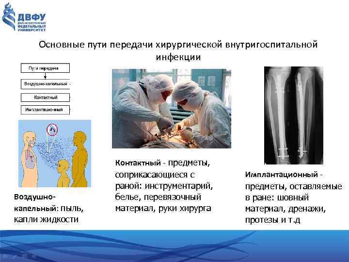 Основные пути передачи хирургической внутригоспитальной инфекции Воздушнокапельный: пыль, капли жидкости Контактный предметы, соприкасающиеся с