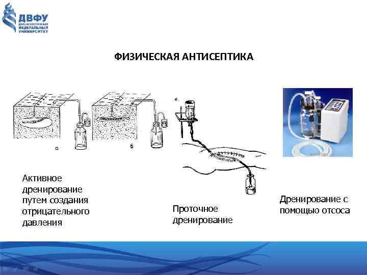 ФИЗИЧЕСКАЯ АНТИСЕПТИКА Активное дренирование путем создания отрицательного давления Проточное дренирование Дренирование с помощью отсоса