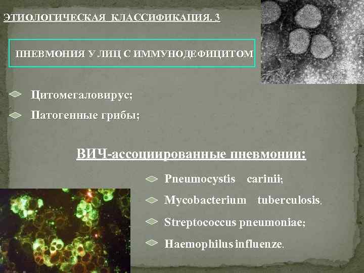 ЭТИОЛОГИЧЕСКАЯ КЛАССИФИКАЦИЯ. 3 ПНЕВМОНИЯ У ЛИЦ С ИММУНОДЕФИЦИТОМ Цитомегаловирус; Патогенные грибы; ВИЧ-ассоциированные пневмонии: Pneumocystis