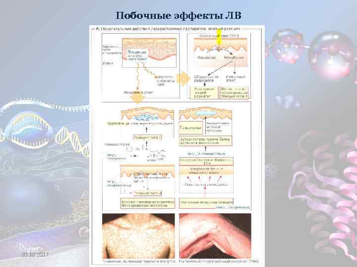 Побочные эффекты ЛВ 10. 2017 