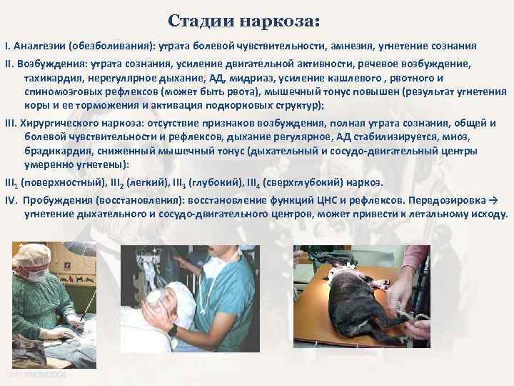 Стадии наркоза: I. Аналгезии (обезболивания): утрата болевой чувствительности, амнезия, угнетение сознания II. Возбуждения: утрата
