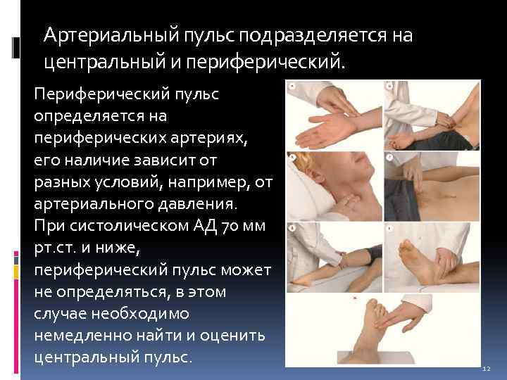 Артериальный пульс подразделяется на центральный и периферический. Периферический пульс определяется на периферических артериях, его