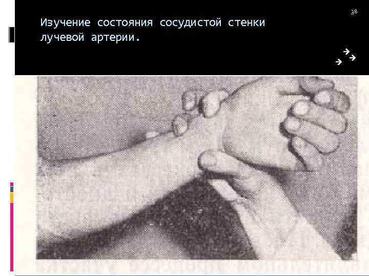 Изучение состояния сосудистой стенки лучевой артерии. 38 
