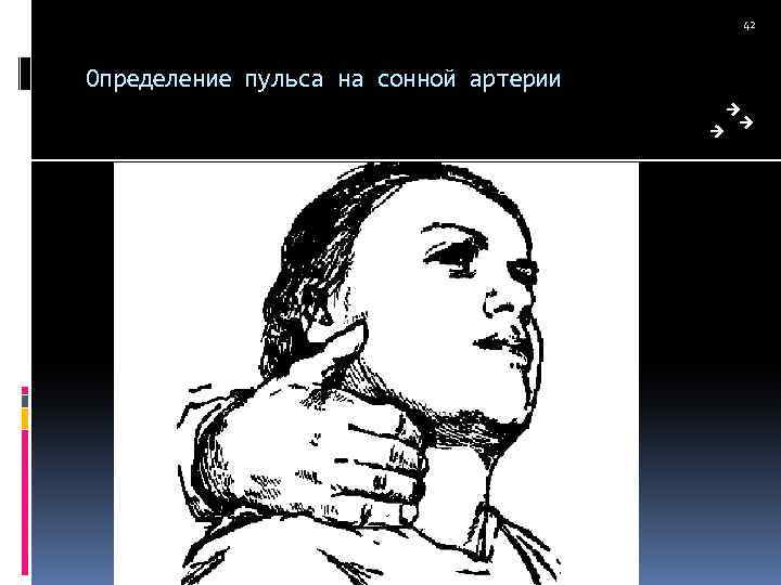 42 Определение пульса на сонной артерии 
