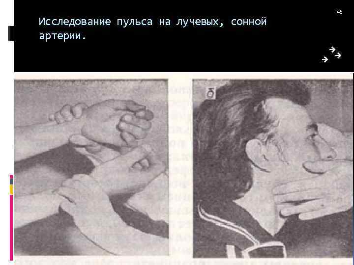 Исследование пульса на лучевых, сонной артерии. 45 