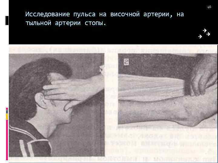 46 Исследование пульса на височной артерии, на тыльной артерии стопы. 