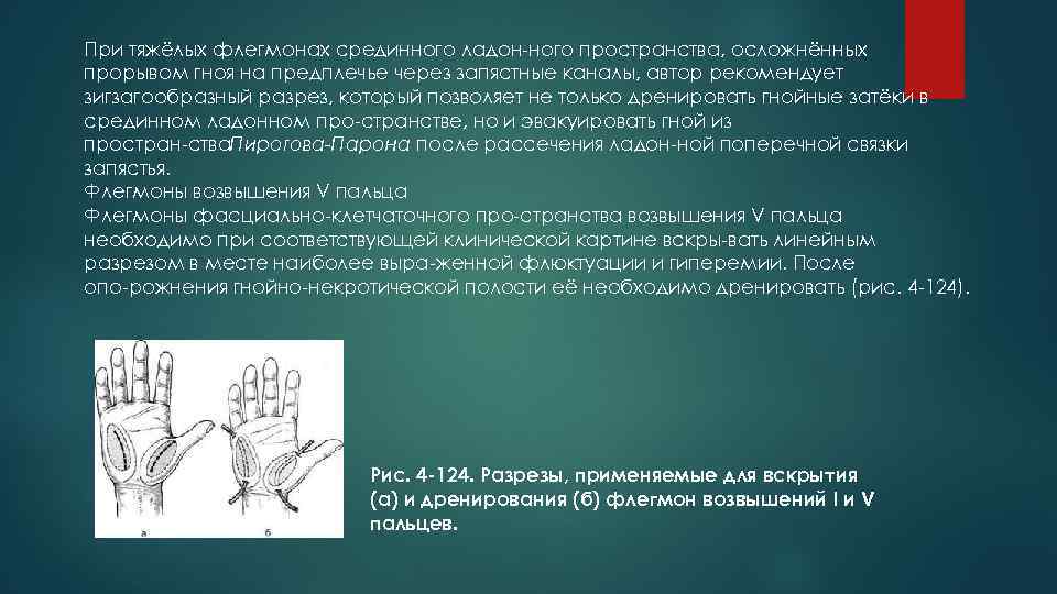 При тяжёлых флегмонах срединного ладон ного пространства, осложнённых прорывом гноя на предплечье через запястные