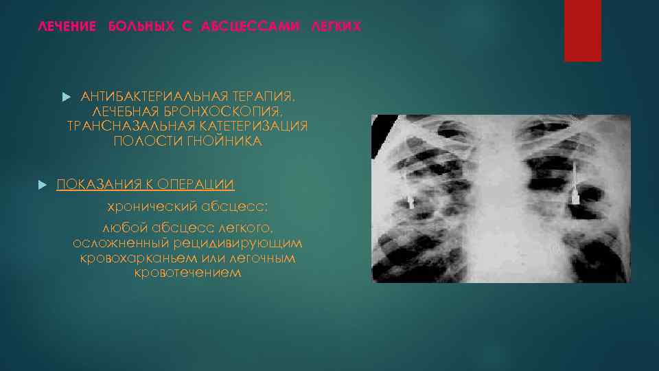 История болезни абсцесс легкого