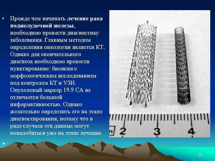  • Прежде чем начинать лечение рака поджелудочной железы, необходимо провести диагностику заболевания. Главным