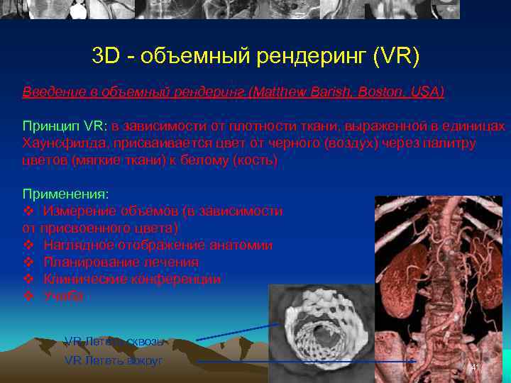 3 D - объемный рендеринг (VR) Введение в объемный рендеринг (Matthew Barish, Boston, USA)