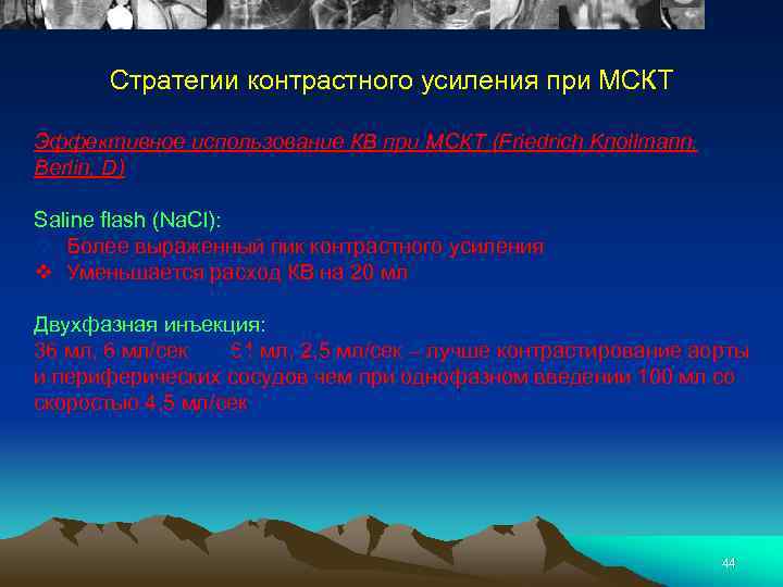 Стратегии контрастного усиления при МСКТ Эффективное использование КВ при МСКТ (Friedrich Knollmann, Berlin, D)